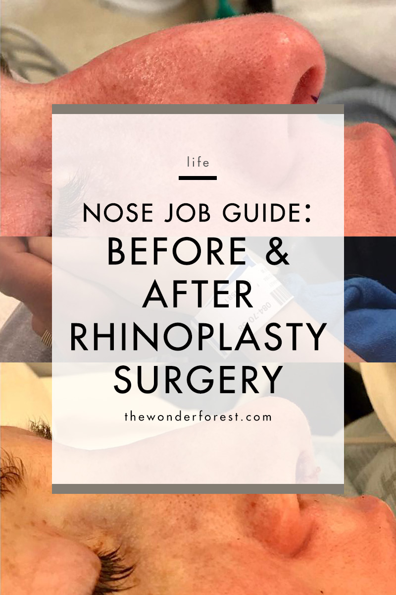 Complete Guide to Getting a Nose Job